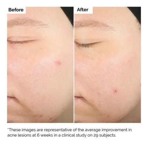 The Ordinary Deciem Exfoliantes Salicylic Acid 2% Solution N Normal Night