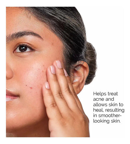 The Ordinary Deciem The Acne Set Acne-prone Pack 3
