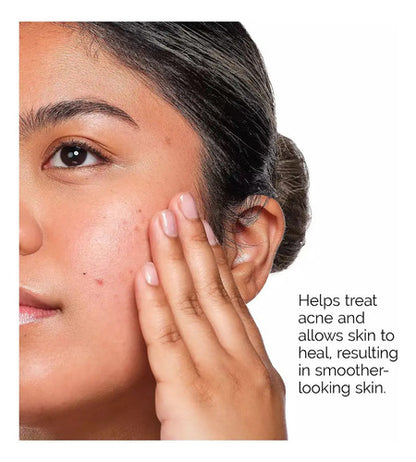 The Ordinary Deciem The Acne Set Acne-prone Pack 3