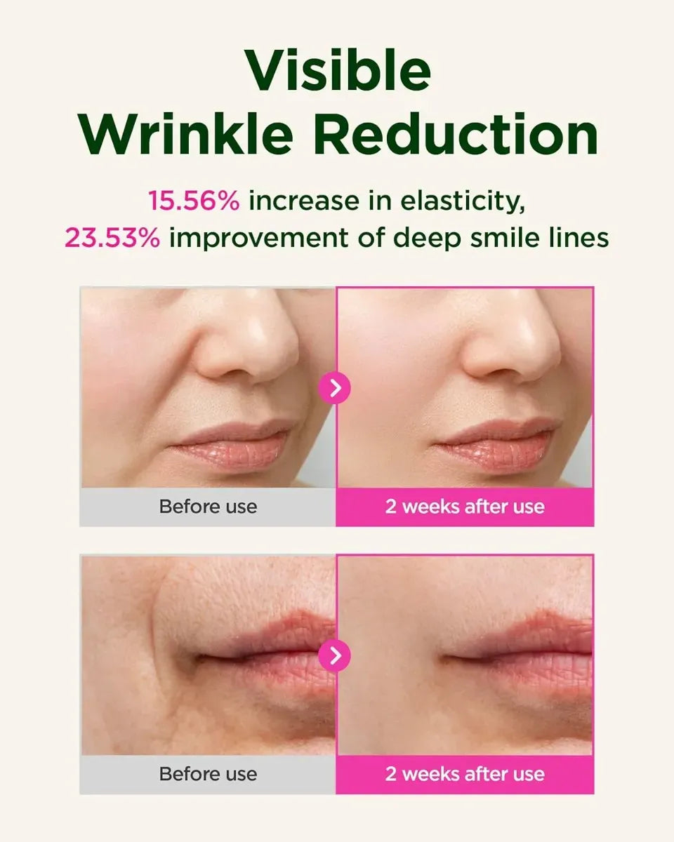 Ckd Retino Collagen Guasha Serum Com Roller