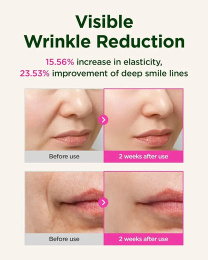 Suero Ckd Retinol Collagen Guasha con Rodillo